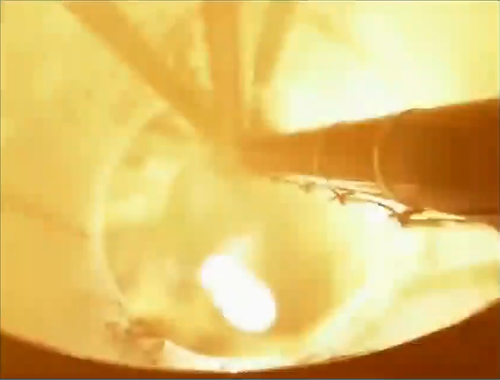 down_the_nozzle2.thumb.png.8a35c2e382485bc0d611736a62bd63e0.png