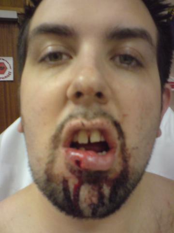 post-21654-1212402602_thumb.jpg