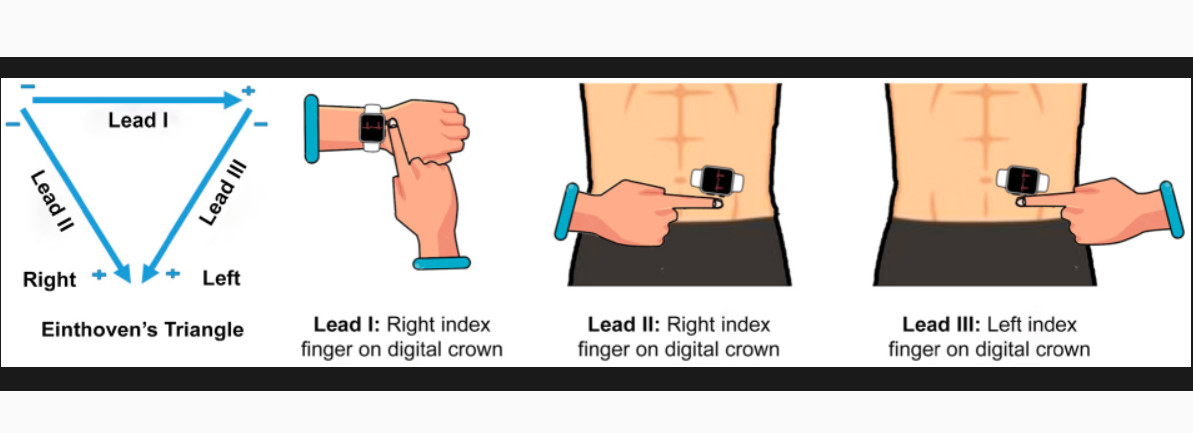 illustration showing how to use the Apple Watch to get leads I II and III